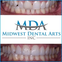 Midwest Dental Arts, Inc